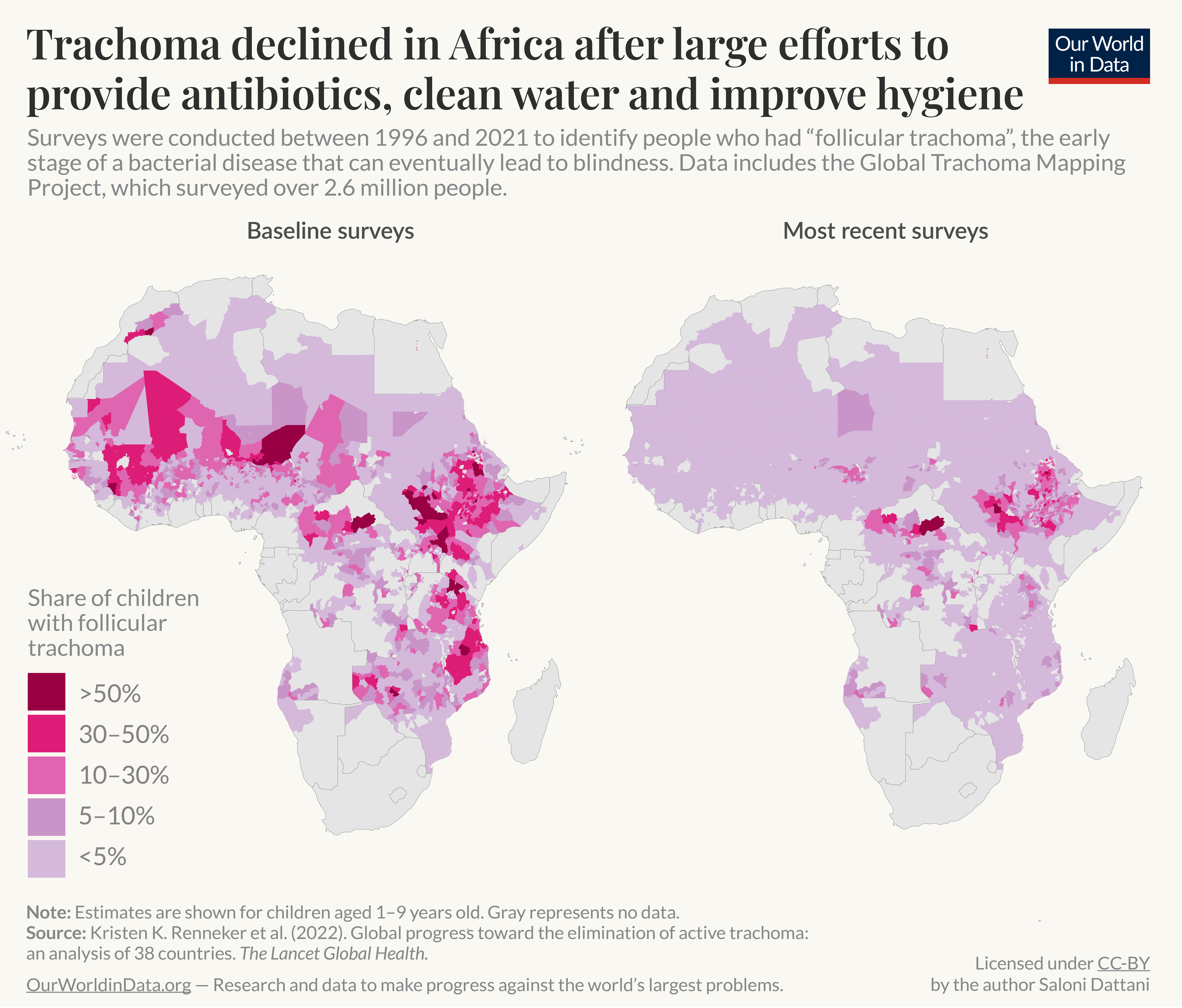 This image displays two maps of Africa side-by-side, comparing the prevalence of follicular trachoma in children aged 1-9 years across various regions from baseline surveys to the most recent surveys. The left map shows baseline data, while the right map shows more current data. Different colors on the maps indicate the percentage of children affected by trachoma: light purple represents areas where less than 5% of children are affected, progressing through shades of light purple to bright and dark pink, where over 50% of children are affected. The image highlights the decline in trachoma prevalence due to large-scale health interventions like antibiotics, surgeries, and hygiene improvements from 1996 to 2021, based on surveys conducted in 38 countries and involving over 2.6 million people. This chart was created by Saloni Dattani at Our World in Data using data from the study by Kristen Renneker et al. (2022). Global progress toward the elimination of active trachoma: an analysis of 38 countries.