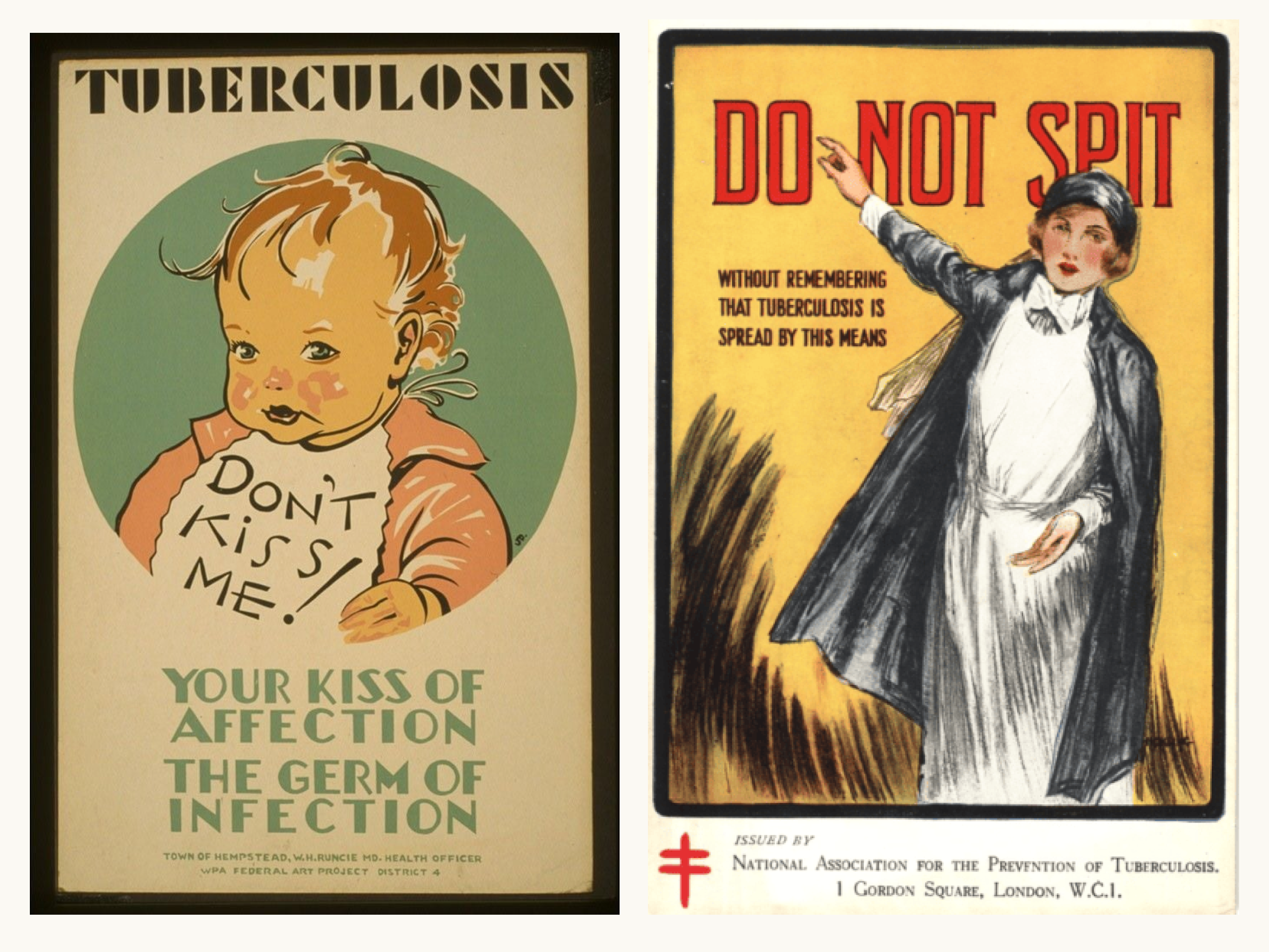 On the left, there is a vintage health poster featuring an illustrated baby with curly hair and a chubby face. The baby is smiling and wearing a bib that says "DON'T KISS ME!" Above the child, the word "TUBERCULOSIS" is boldly displayed in large letters. The poster emphasizes the message that the affection of a kiss can spread germs.

On the right, another vintage poster shows a woman dressed in an early 20th-century outfit, including a long coat, and gesturing with one hand raised. The text at the top reads "DO NOT SPIT," while a cautionary statement below explains that tuberculosis is spread this way. The poster is designed with a strong visual contrast, using a yellow background and a drawing style that adds an element of urgency to the message. 

At the bottom of this poster, there is a note indicating it was issued by the National Association for the Prevention of Tuberculosis, located at 1 Gordon Square, London, W.C.1.